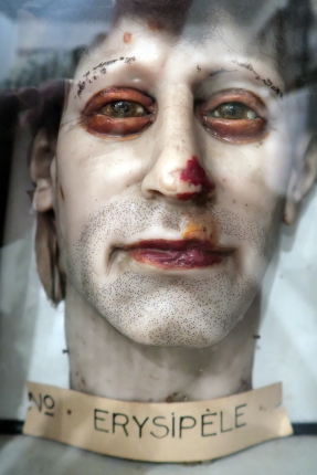 geneeskundemuseum brussel 8-2025 3177